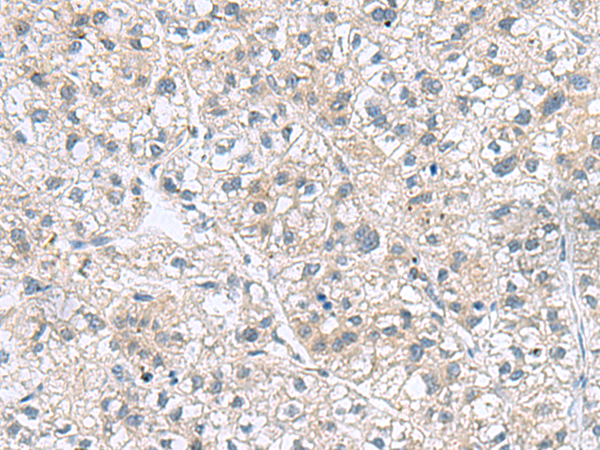 GEMIN7 Antibody[47433]