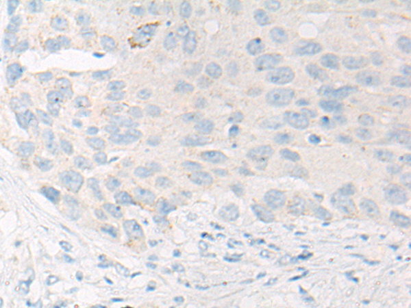 CCP110 Antibody[46945]