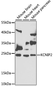KCNIP2 Polyclonal Antibody[308