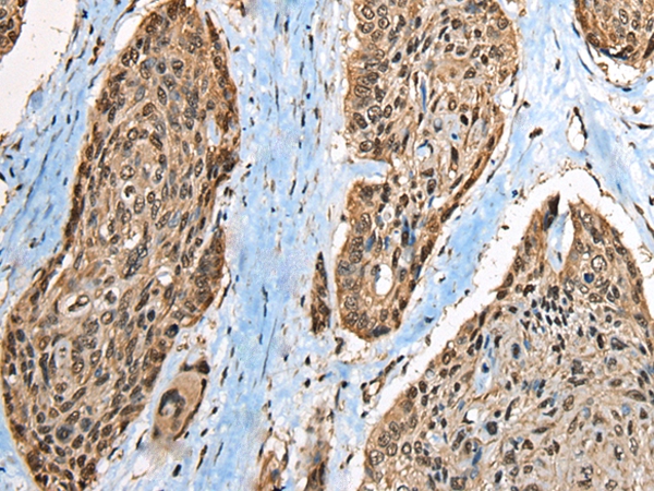 CCDC137 Antibody[46419]