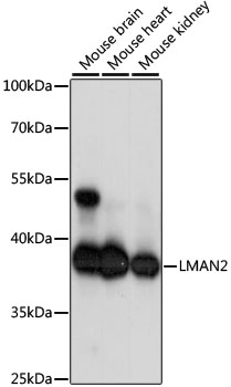LMAN2 Polyclonal Antibody[2894