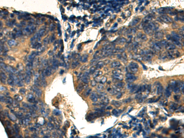 GLIPR2 antibody[43482]