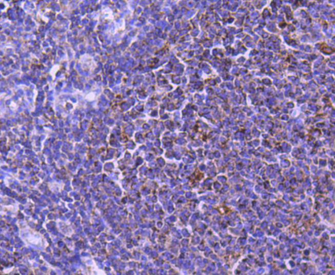 STAT6 Rabbit mAb[48795]