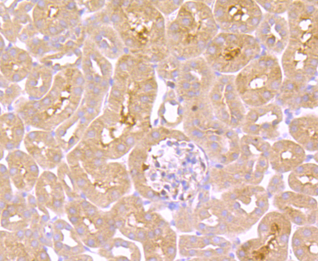 TNF Receptor II Rabbit mAb[494