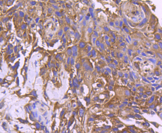 CD10 Rabbit mAb[49098]