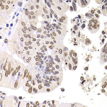 SOX5 Polyclonal Antibody[30782