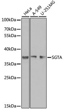 SGTA Polyclonal Antibody[30885