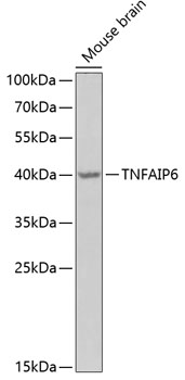 TNFAIP6 Polyclonal Antibody[30