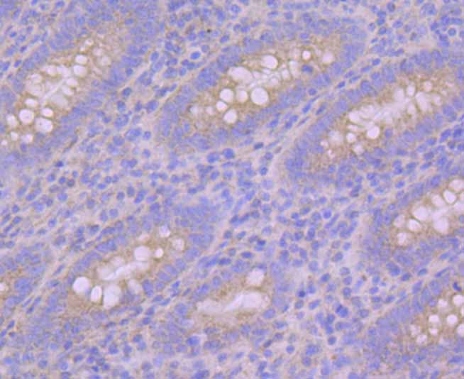 Pumilio 1 Rabbit mAb[49885]