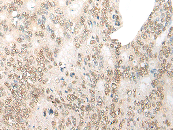 CDX4 Antibody[46947]
