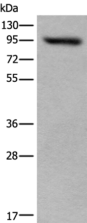 USP6NL Antibody[46700]