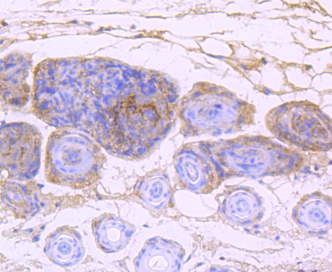 EGFR Rabbit mAb[48691]