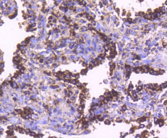 Hsp60 Rabbit mAb[48882]