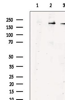 FUNDC1 Polyclonal Antibody[298
