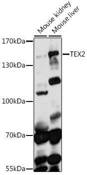 TEX2 Polyclonal Antibody[28674