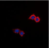 NHE8 Antibody[47857]