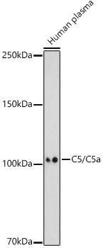 C5 Polyclonal Antibody[31439]