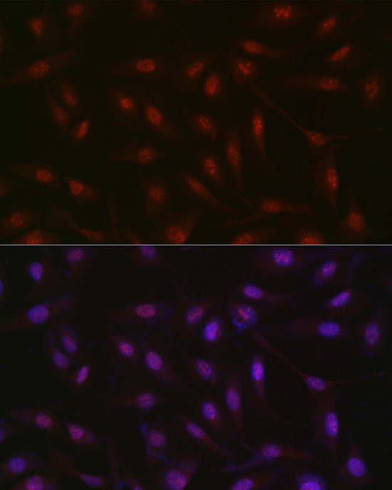 RBM14 Polyclonal Antibody[2792