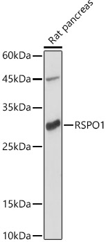 RSPO1 Polyclonal Antibody[3149