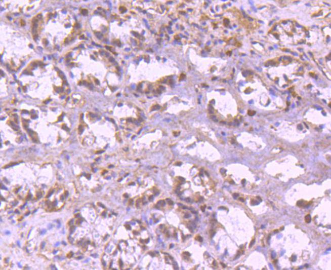 YY1 Rabbit mAb[48730]