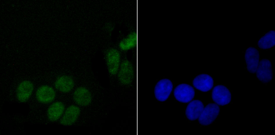 DDX5 Rabbit mAb[49625]