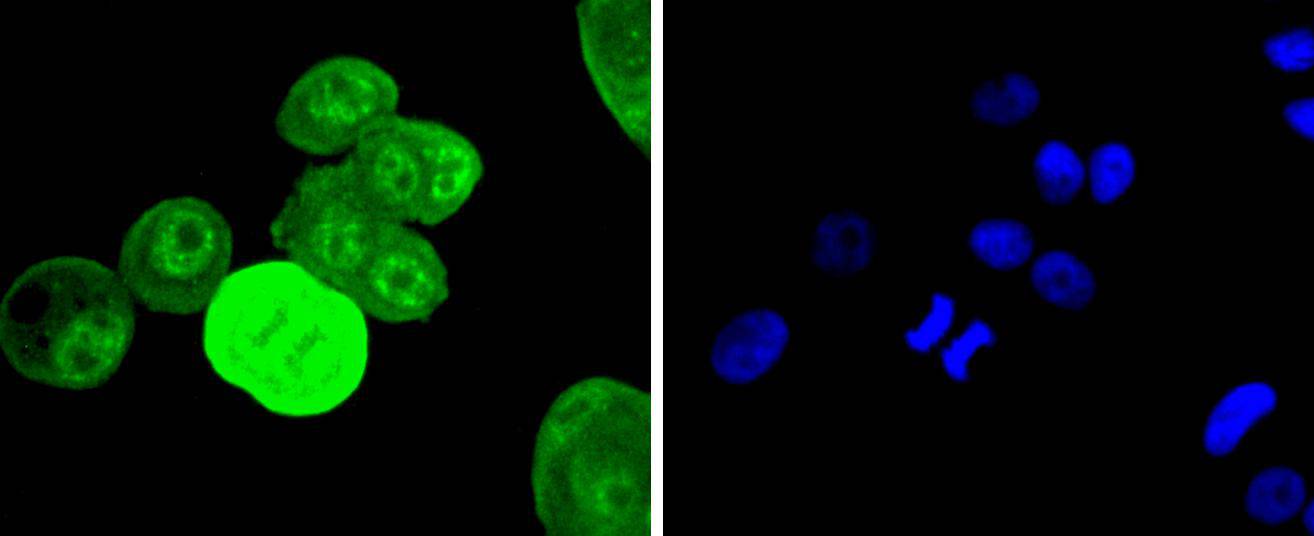 Phospho-EGFR(Y1068) Rabbit mAb