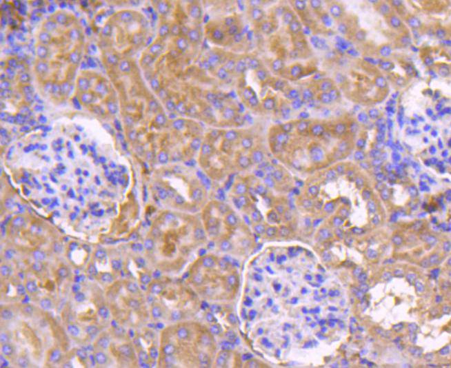 PDPK1 Rabbit mAb[49136]