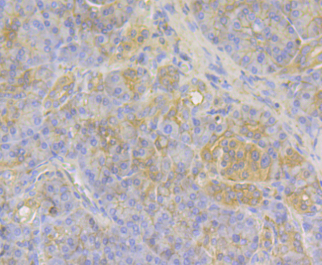 MGEA5 Rabbit mAb[49964]