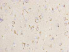 Neuropilin 1 Antibody[48067]