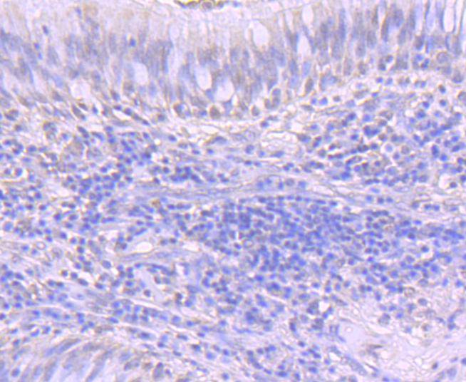 ATF1 Rabbit mAb[49239]