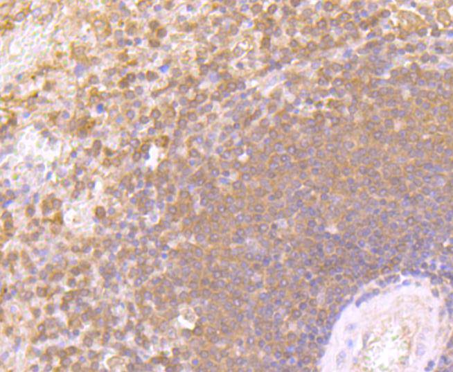 Interferon gamma Rabbit mAb[49