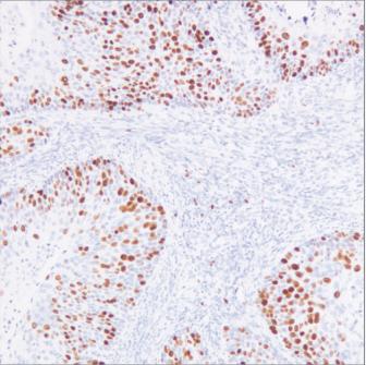 Ki-67 Antibody[P1010]
