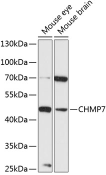 CHMP7 Polyclonal Antibody[2851