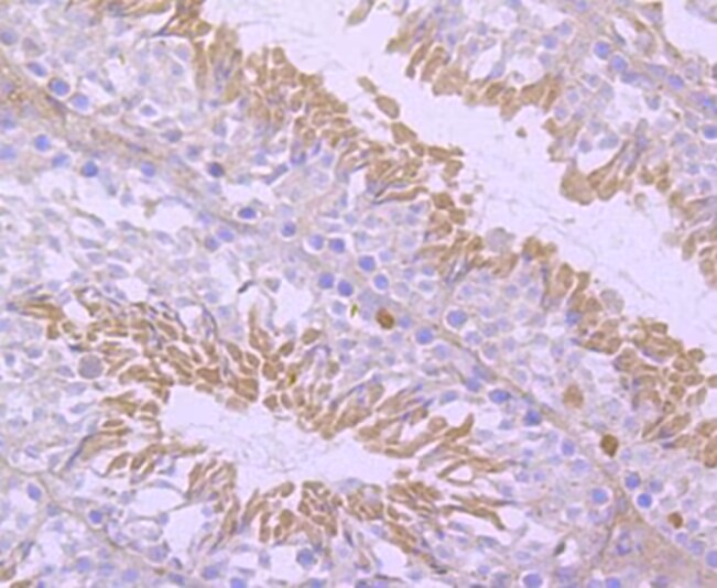 NUR77 Rabbit mAb[49510]