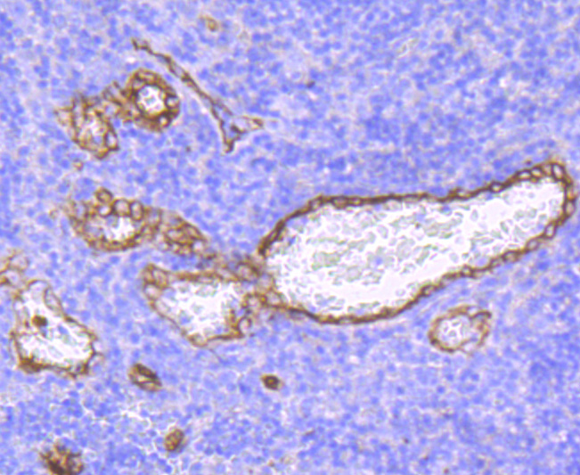 Claudin 5 Rabbit mAb[49471]