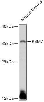 RBM7 Polyclonal Antibody[30094