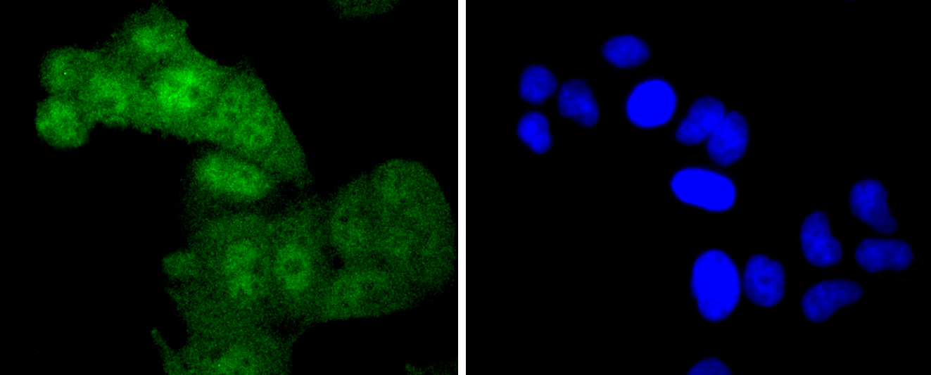 Phospho-c-Myc(T58) Rabbit mAb[