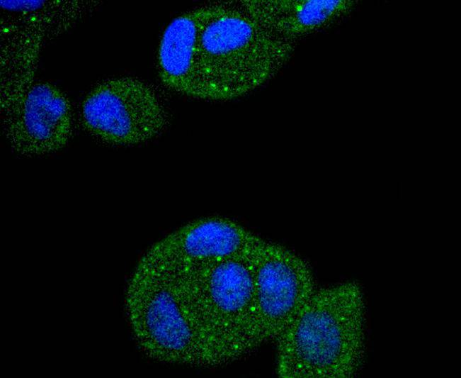 APC6 Rabbit mAb[49201]