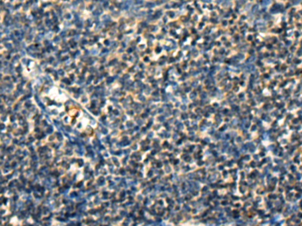 GLIPR2 antibody[43482]