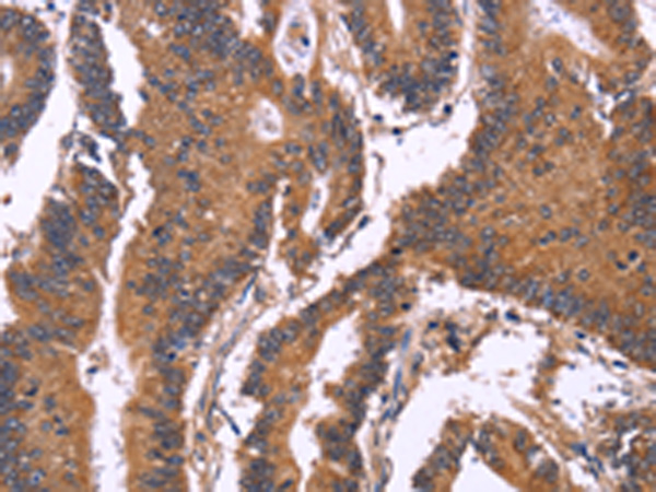 SEPT7 Antibody[47243]