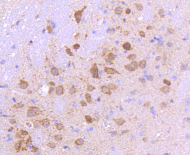 Smad3 Rabbit mAb[48783]