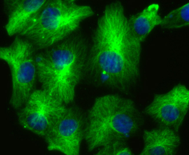 LOXL2 Rabbit mAb[49699]