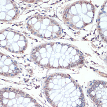 c-Jun Polyclonal Antibody[2908