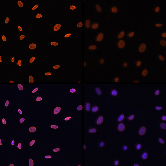 Acetyl-Histone H4-K12 pAb[2846