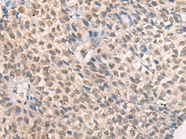 PRMT6 Antibody[46648]