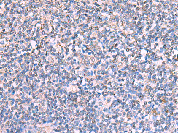 FDXR antibody[31868]