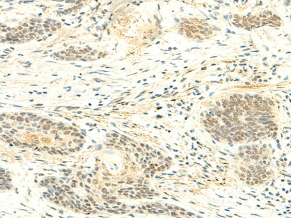 ATMIN Antibody[47728]