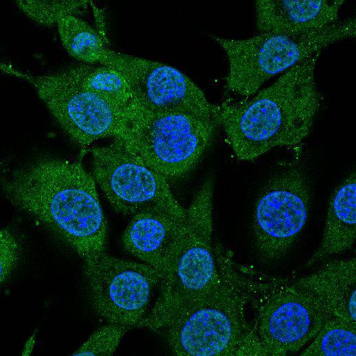 BDNF Antibody[48503]