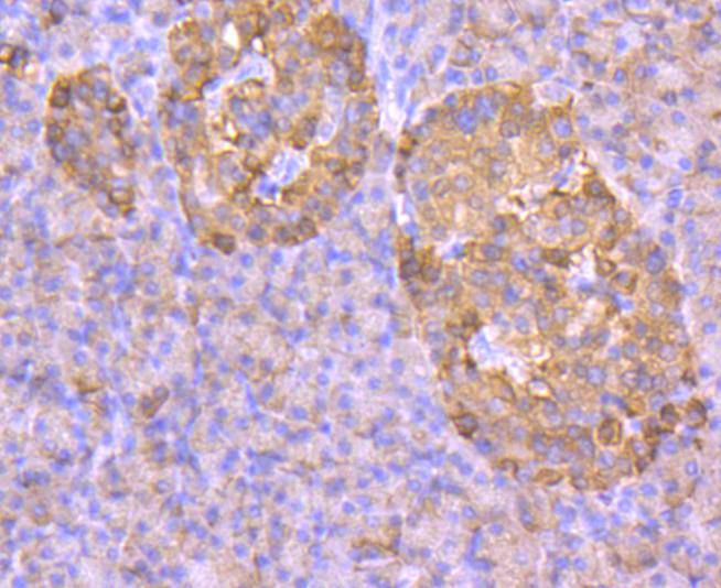 GLUT2 Rabbit mAb[49243]