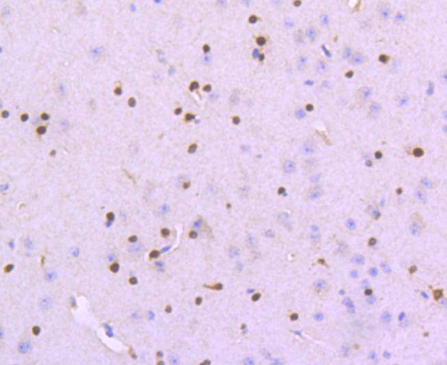 SOX10 Rabbit mAb[49193]